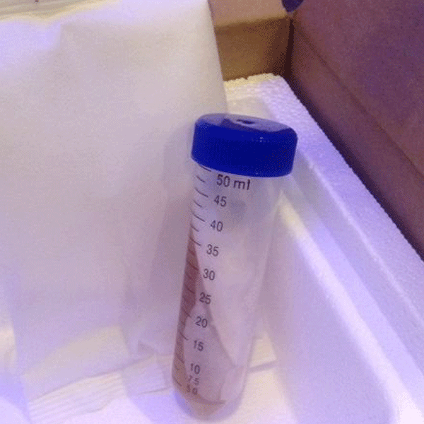Lab Supplies | Agar Plates, Slants, Liquid Culture & Grow Bags ...